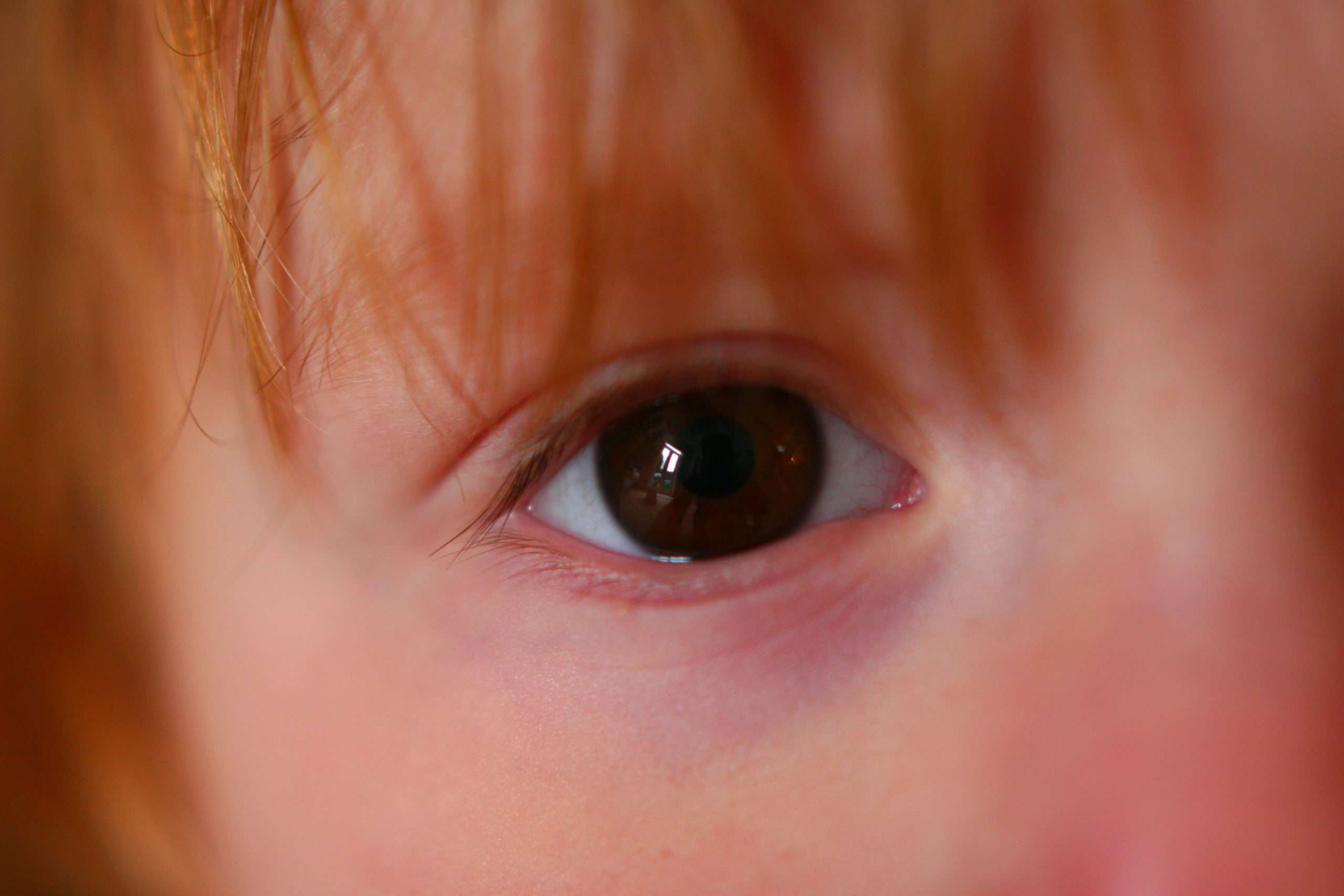 child's eye